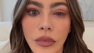 Sofia Vergara falta ao Emmy, surge de olho inchado e preocupa fãs