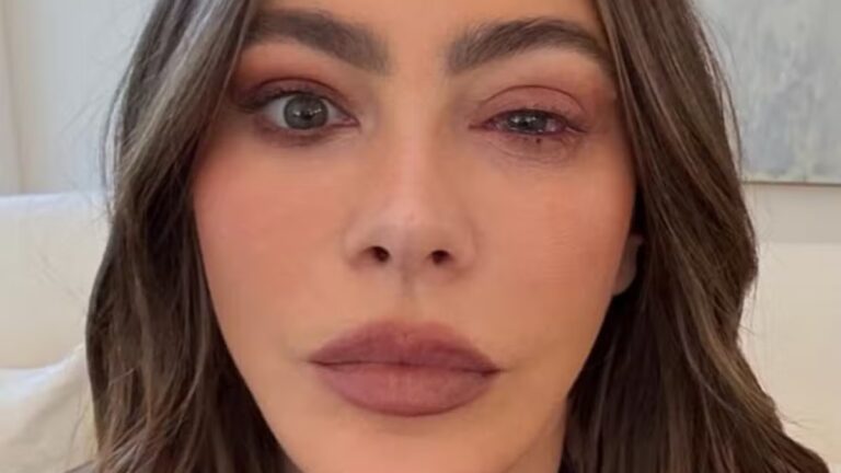Sofia Vergara falta ao Emmy, surge de olho inchado e preocupa fãs