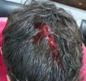 Ação rápida das polícias resulta na prisão de dois suspeitos por tentativa de homicídio em Sonora