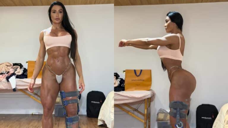 Gracyanne Barbosa exibe o corpo após lesão no "Dança dos Famosos"