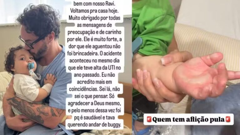 Eliezer atualiza saúde do filho após cirurgia por queimadura