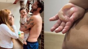 Filho de Viih Tube e Eli sofre queimadura e passa por cirurgia