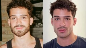 João Guilherme surge “diferente” e público suspeita de retoques