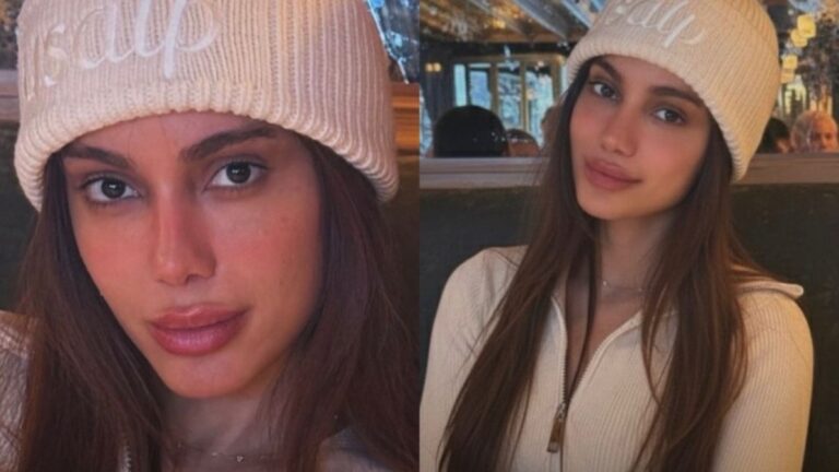 Rosto de Natal: Anitta surpreende ao exibir mais um novo visual