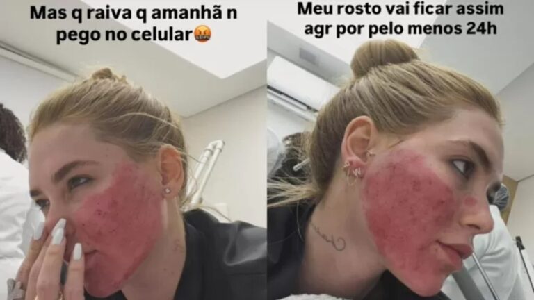 Virginia surpreende ao mostrar rosto após procedimentos estéticos