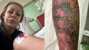 Influencer expõe drama após complicação causada por tatuagem